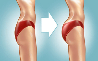 Comment grossir des fessiers rapidement et naturellement ?