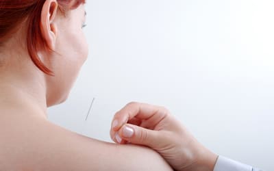 points d'acupuncture coupe-faim