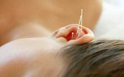 point d'acupuncture pour maigrir