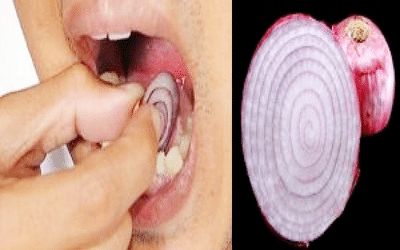 Soigner une rage de dents par Le jus d’oignon