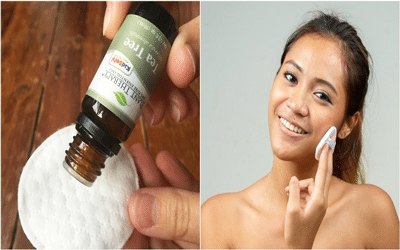 pore dilaté que faire huile essentielle