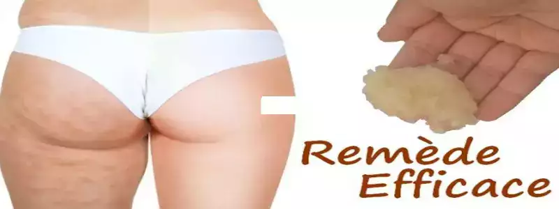 Comment se débarrasser de la cellulite naturellement